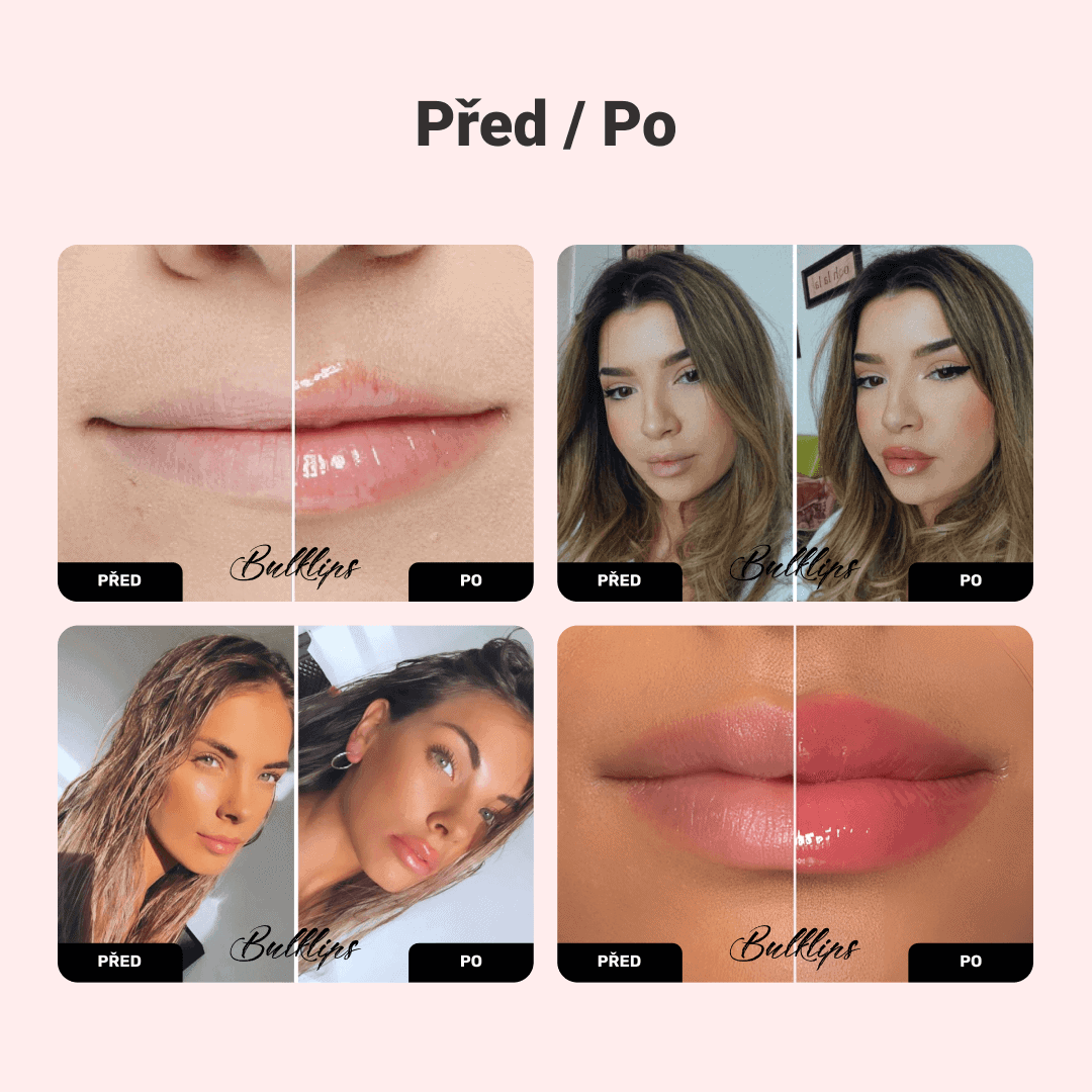 Zázvorová & Mátová BULKLIPS sada pro zvětšení rtů - Obrázek 3